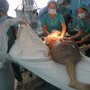 Une équipe de chirurgiens tente d'opérer le genou d'un enfant (...)